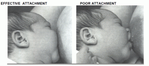 breastfeedingattachment